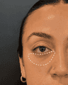 thumbnail before image